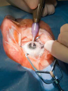 Corneal-Repair